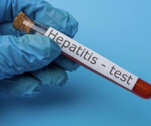 OMS: El mundo se enfrenta a un brote de hepatitis ‘de origen desconocido’ que afecta a niños
