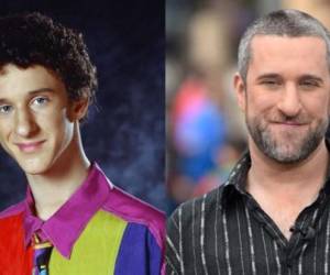 Según Roger Paul, su representante, Dustin Diamond, quien tenía 44 años, apenas fue diagnosticado hace tres semanas con carcinoma, un cáncer maligno que en ese tiempo “se extendió por su organismo”.