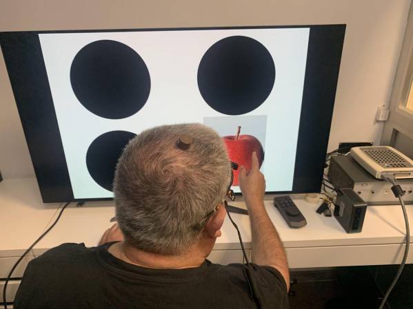 <i>Un paciente con ceguera total causada por un daño irreversible en el nervio óptico ha recuperado parcialmente la visión a partir de un ensayo clínico de microestimulación eléctrica cerebral. EFE/ Universidad Miguel Hernández (UMH)</i>