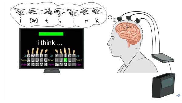 <i>El estudio, liderado por investigadores del Instituto de Neurociencia del Mass General Brigham y la Universidad de Brown describe una neuroprótesis de escritura con interfaz cerebro-computadora (iBCI, por sus siglas en inglés) que se encuentra en fase de investigación y que puede restaurar la comunicación con rapidez y precisión. Fotografía facilitada por Mass General Brigham</i>