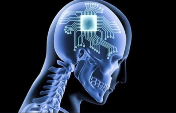 Elon Musk asegura que curará la esquizofrenia con Neuralink, su chip cerebral de IA