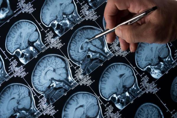 Consiguen predecir si un anciano sano desarrollará Alzheimer