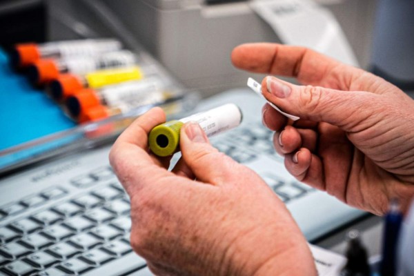 Realizan primera prueba con humanos de vacuna contra Covid-19