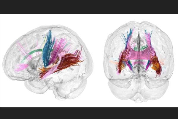 <i>Hasta ahora, la ciencia había descrito los cambios fisiológicos en el cerebro de la mujer durante el embarazo pero no tanto los neuronales. FOTO EFE</i>